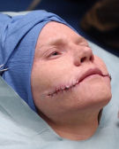 Nip/Tuck