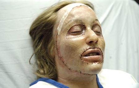 Nip/Tuck